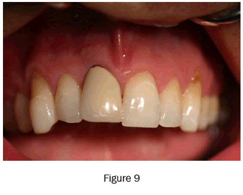 dental-sciences-figure9