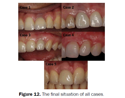 dental-sciences-final-situation-cases