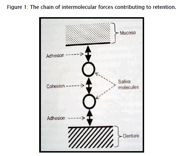 dental-sciences-forces-contributing-retention