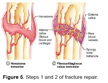 dental-sciences-fracture