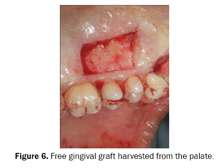 dental-sciences-harvested