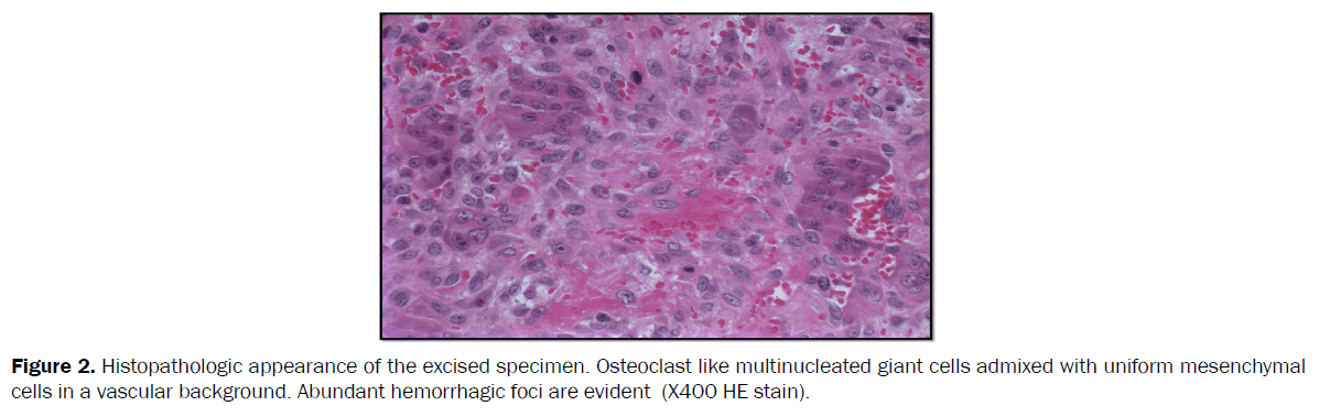 dental-sciences-hemorrhagic-foci-evident