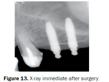 dental-sciences-immediate