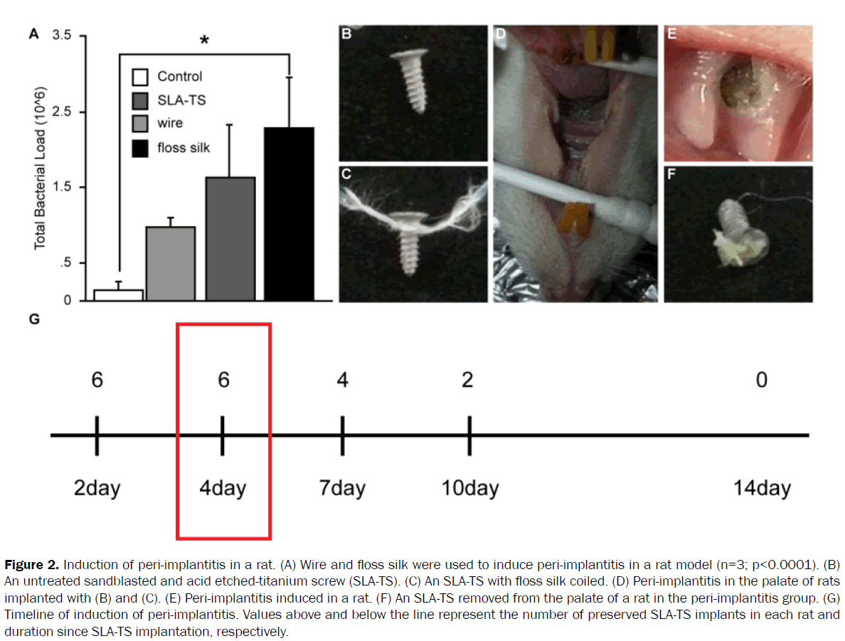 dental-sciences-induction-peri-implantitis