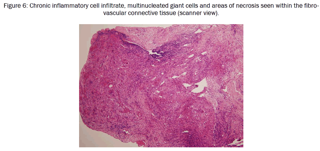 dental-sciences-inflammatory