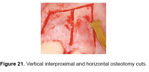 dental-sciences-interproximal