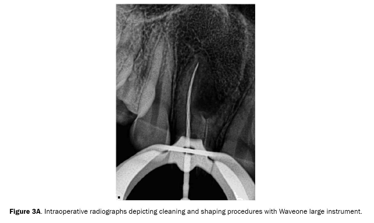 dental-sciences-intraoperative-radiographs