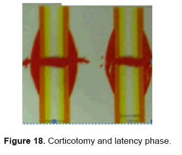 dental-sciences-latency