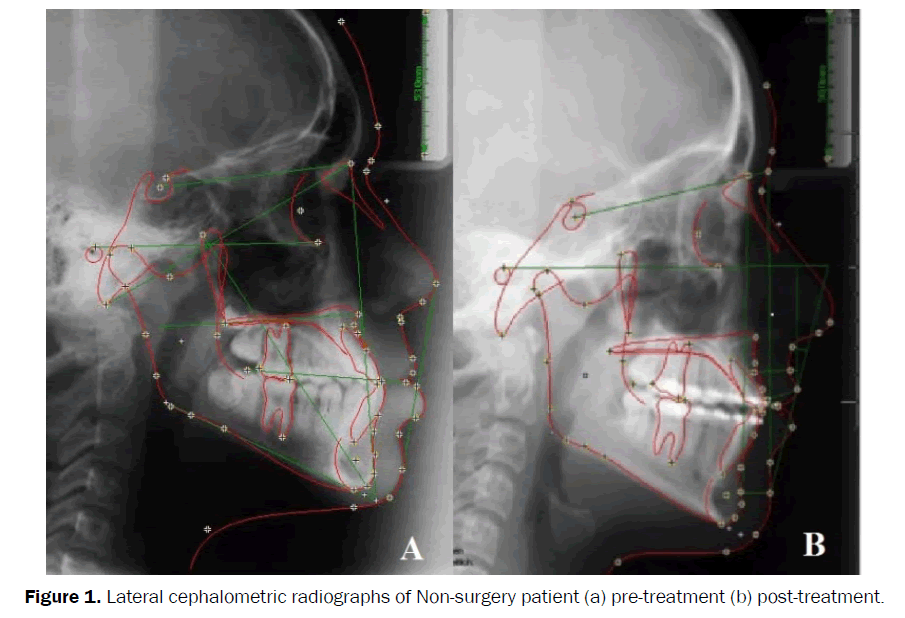 dental-sciences-lateral-cephalometric-radiographs