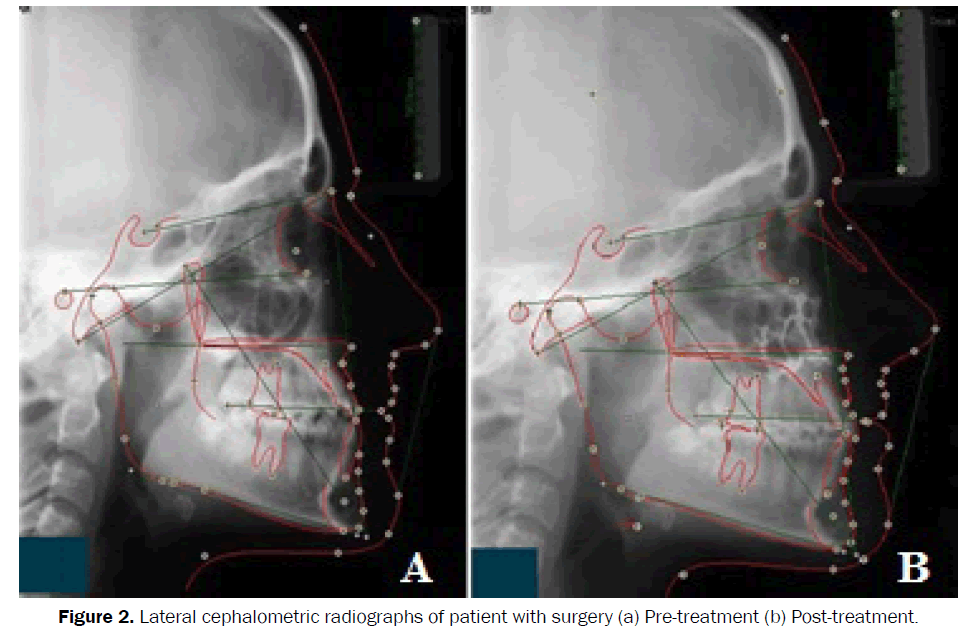 dental-sciences-lateral-cephalometric-radiographs