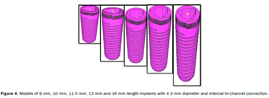 dental-sciences-length-implants-diameter-tri-channel