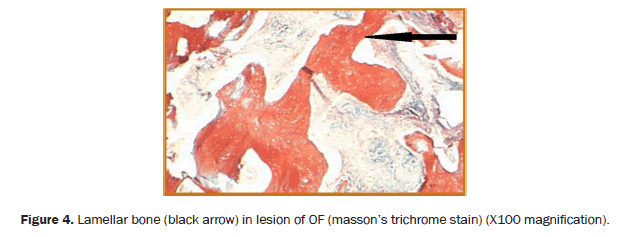 dental-sciences-lesion