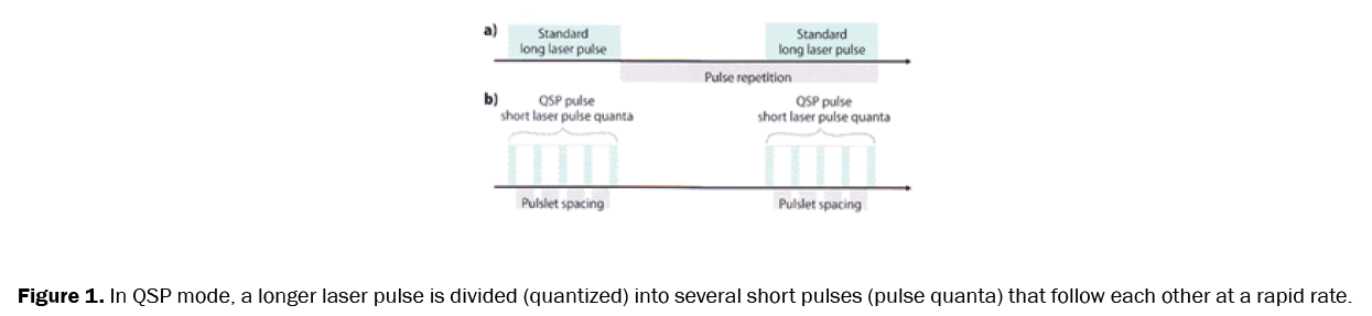 dental-sciences-longer-laser-pulse-divided