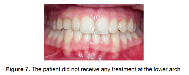 dental-sciences-lower-arch