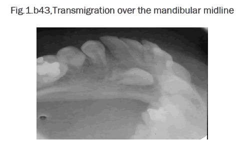 dental-sciences-mandibular-midline