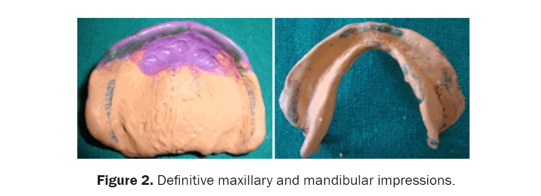 dental-sciences-maxillary