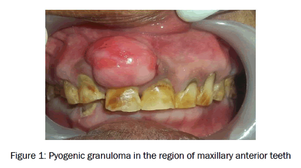 dental-sciences-maxillary-anterior-teeth