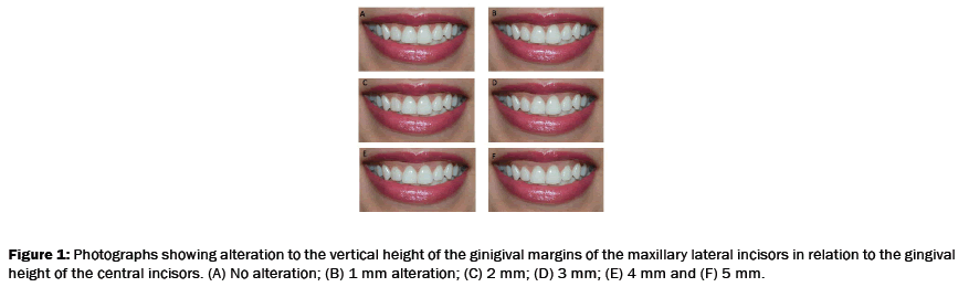 dental-sciences-maxillary-lateral