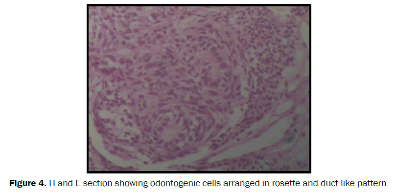 dental-sciences-odontogenic