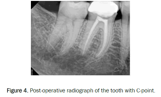dental-sciences-operative-radiograph-tooth