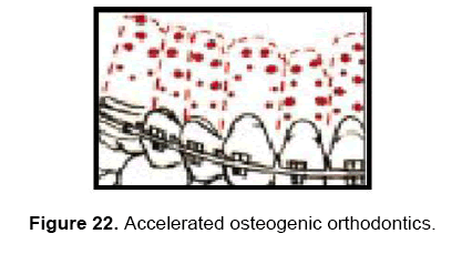 dental-sciences-orthodontics