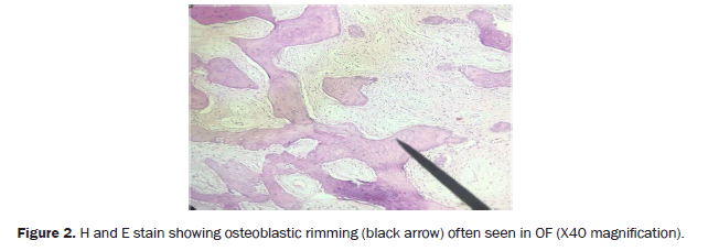 dental-sciences-osteoblastic