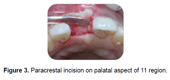 dental-sciences-palatal-aspect