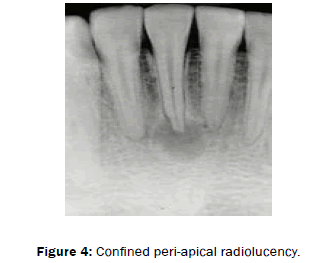 dental-sciences-peri-apical