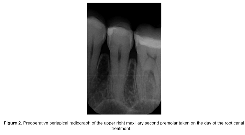 dental-sciences-periapical