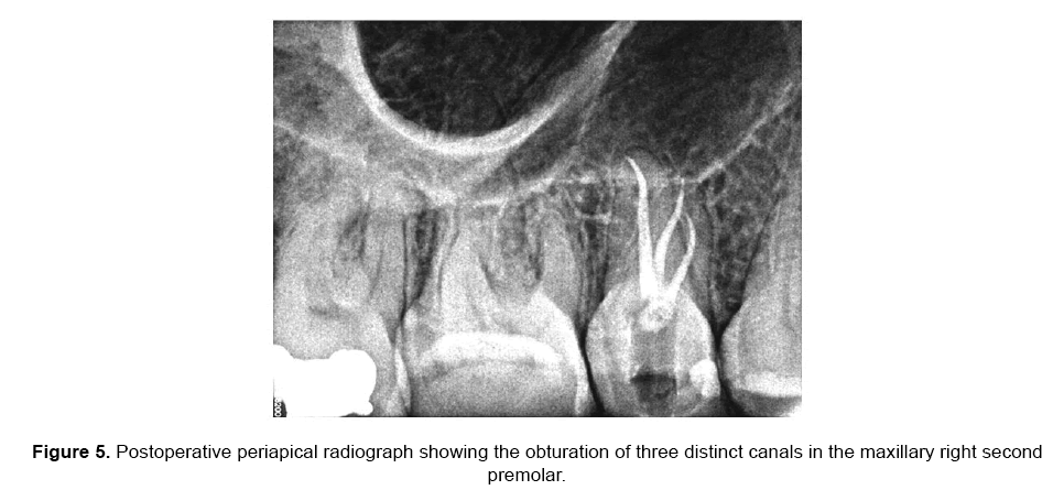 dental-sciences-periapical