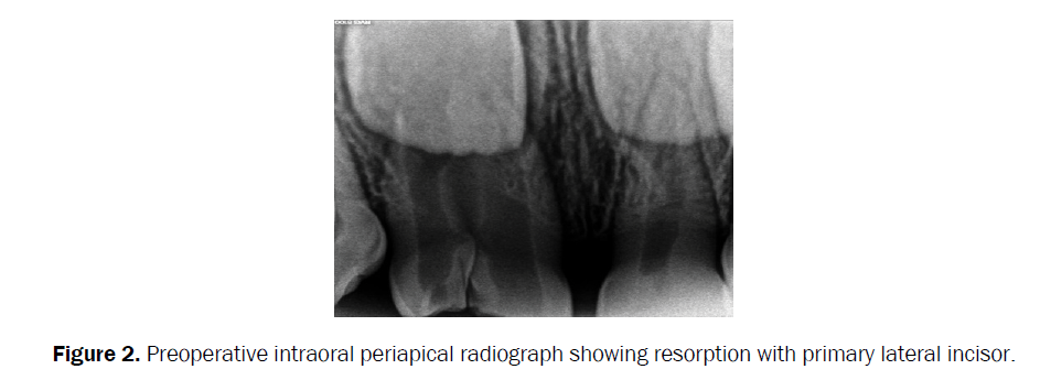 dental-sciences-periapical-radiograph