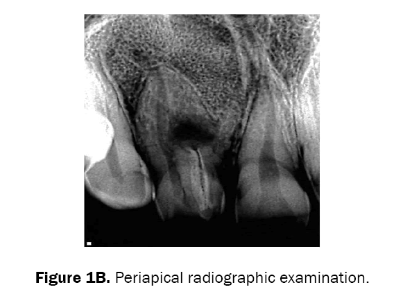 dental-sciences-periapical-radiographic-examination
