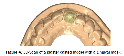 dental-sciences-plaster