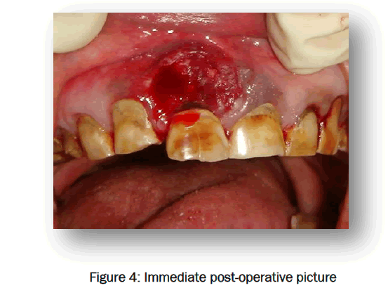 dental-sciences-post-operative-picture