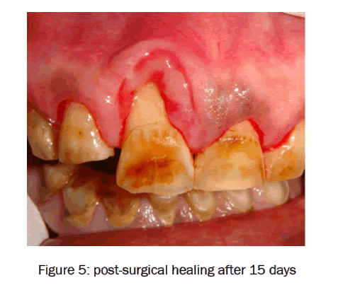 dental-sciences-post-surgical-healing