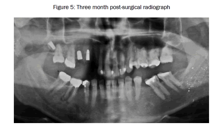 dental-sciences-post-surgical-radiograph