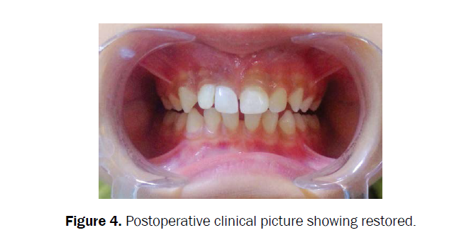 dental-sciences-postoperative-clinical