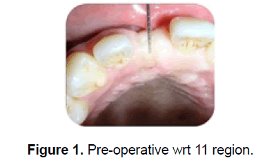 dental-sciences-pre-operative