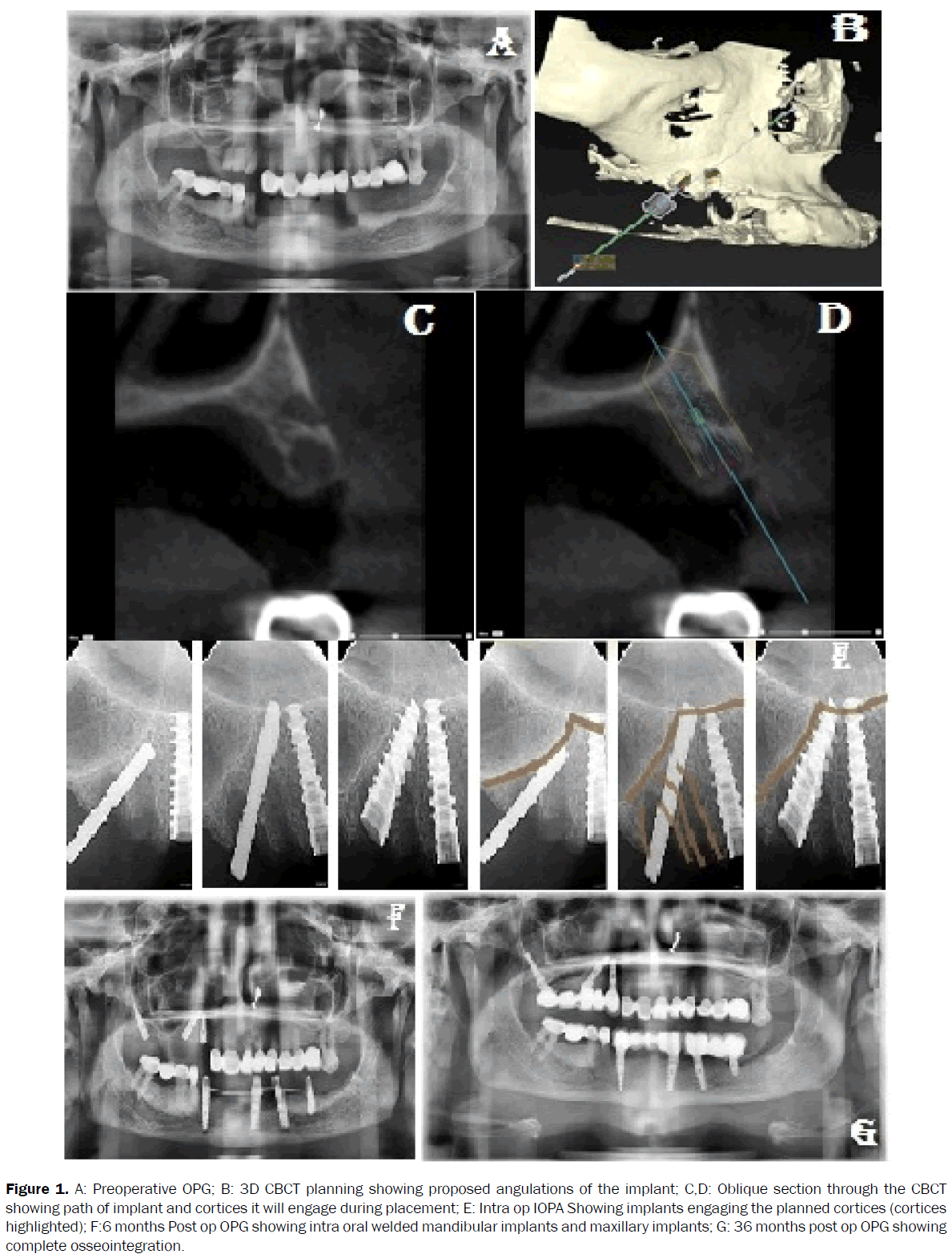 dental-sciences-preoperative-3d-cbct