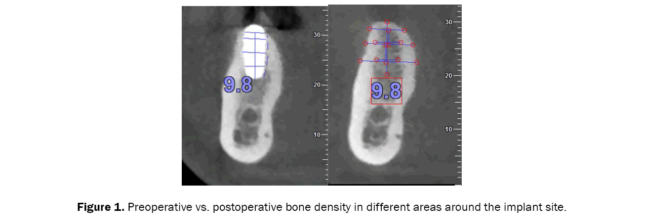 dental-sciences-preoperative