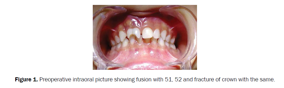 dental-sciences-preoperative-intraoral