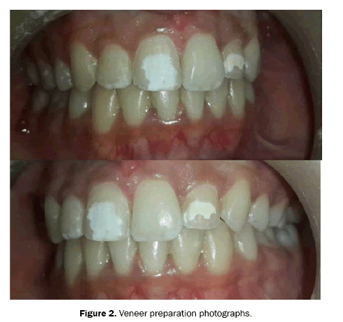 dental-sciences-preparation
