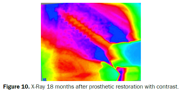 dental-sciences-prosthetic