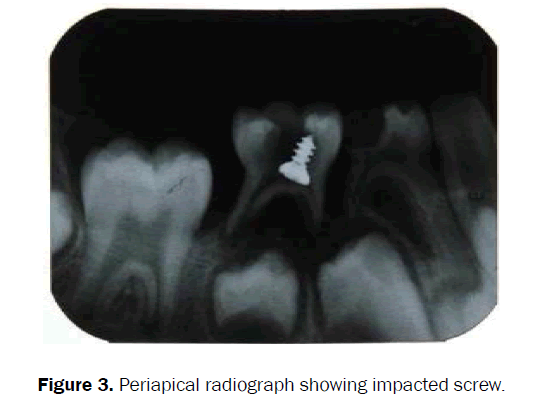 dental-sciences-radiograph