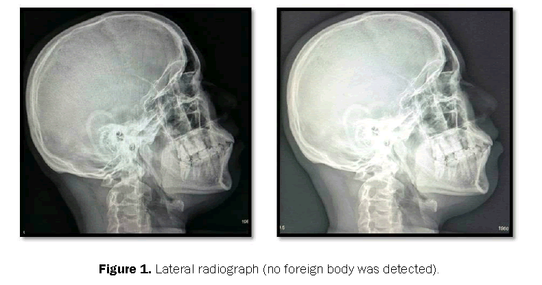 dental-sciences-radiograph