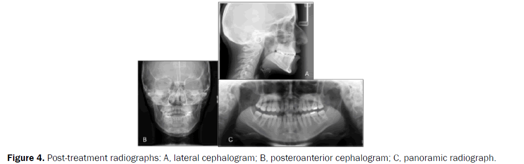 dental-sciences-radiographs