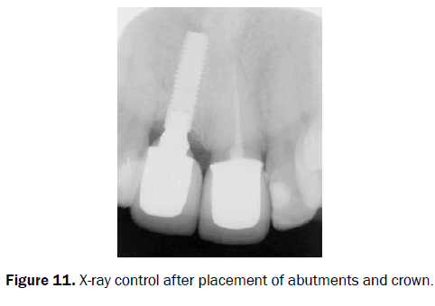 dental-sciences-ray