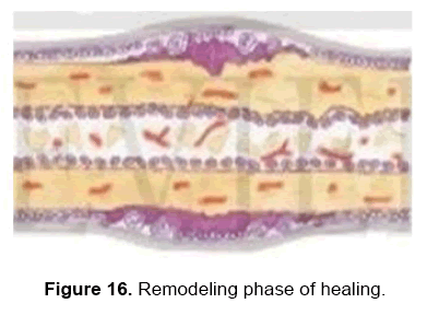 dental-sciences-remodeling