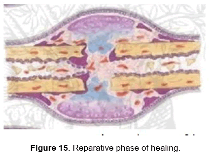 dental-sciences-reparative