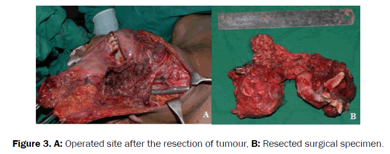 dental-sciences-resected-surgical-specimen